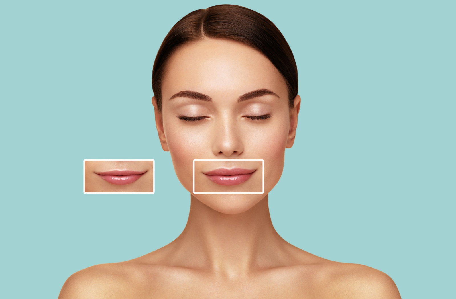 What Are Lip Fillers?