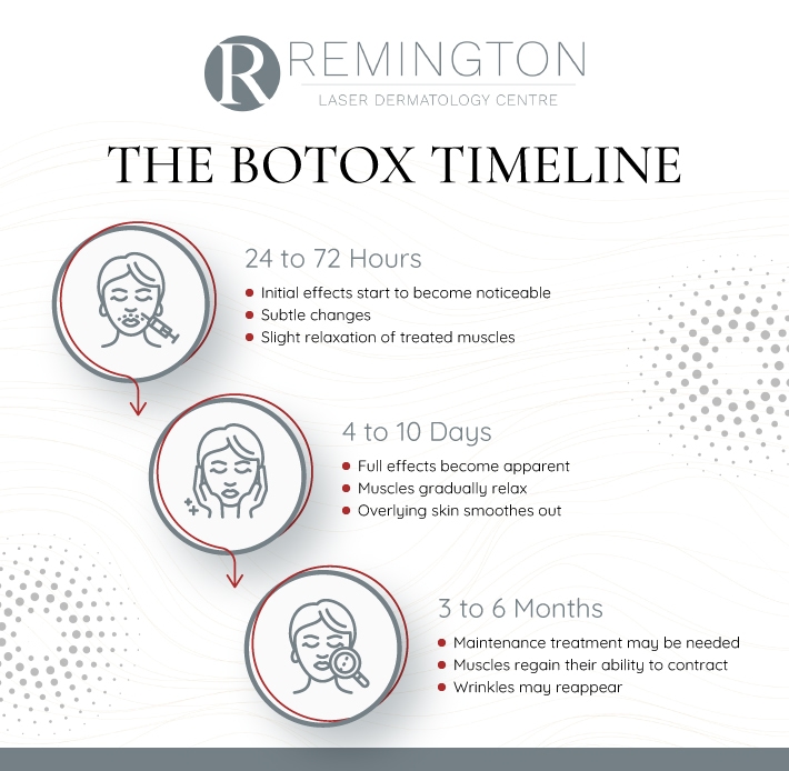 Infographic showing the timeline for botox results.