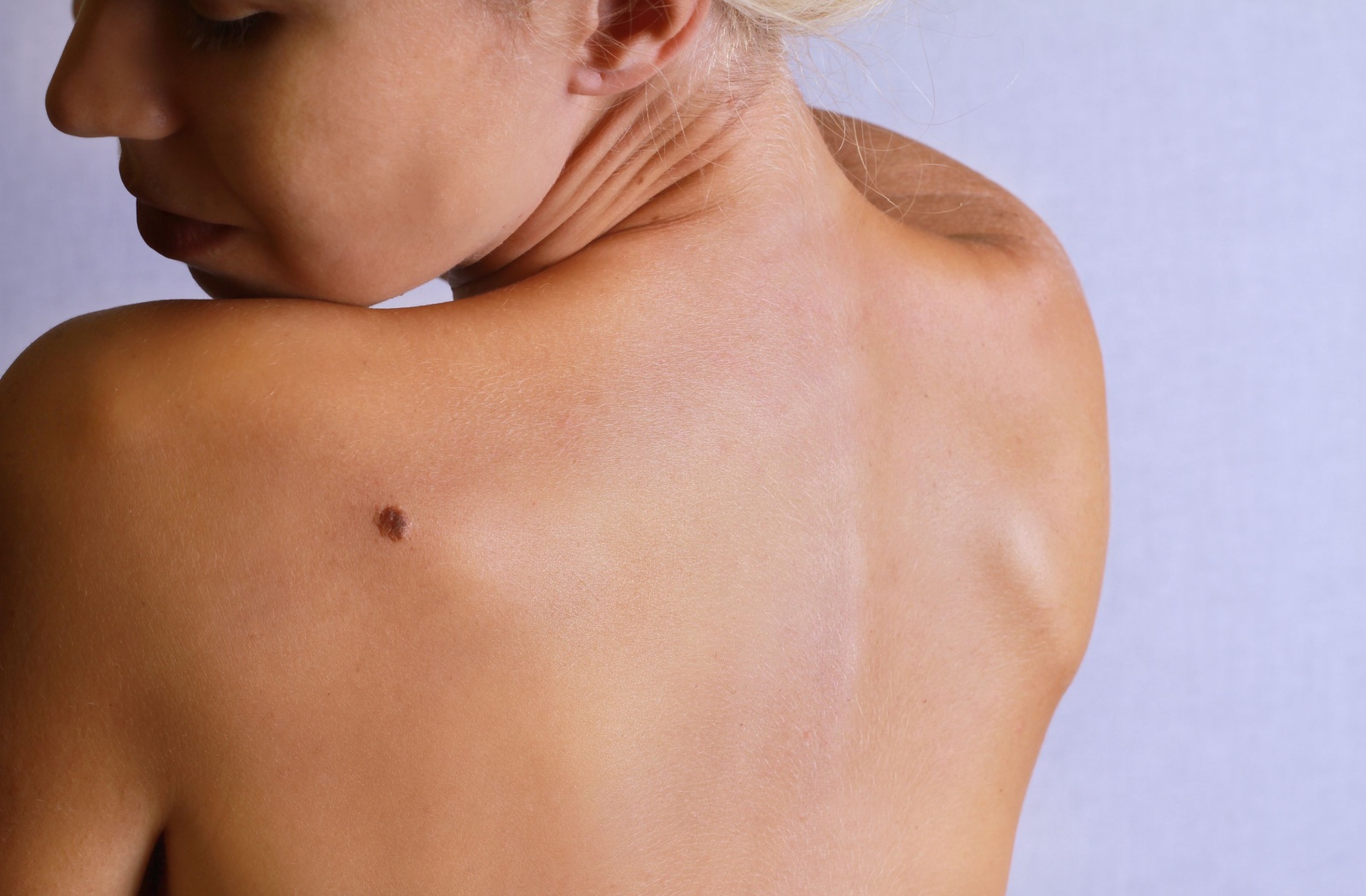 a young woman looking at the birthmark on her back