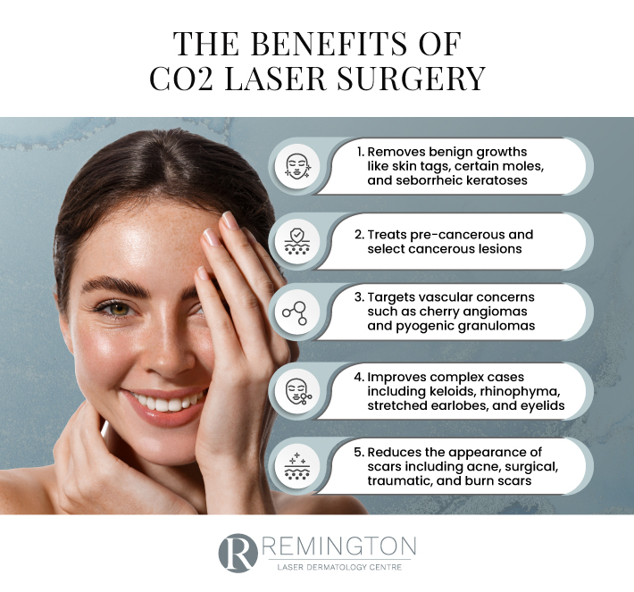 Infographic explaining the benefits of a CO2 laser for your skin