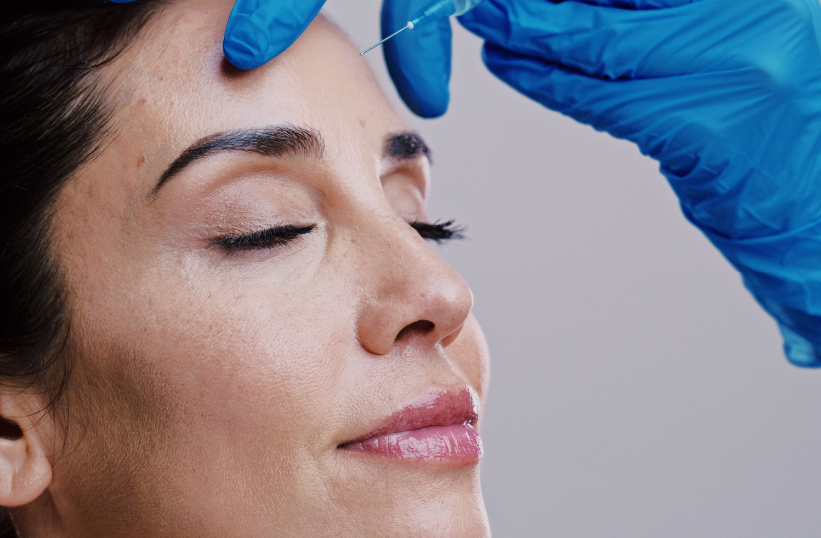 A middle-aged adult getting a dermal filler to minimize forehead lines.
